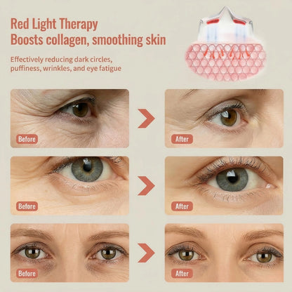 VeRuxy™  LumiEye Therapy Massager Veruxy
