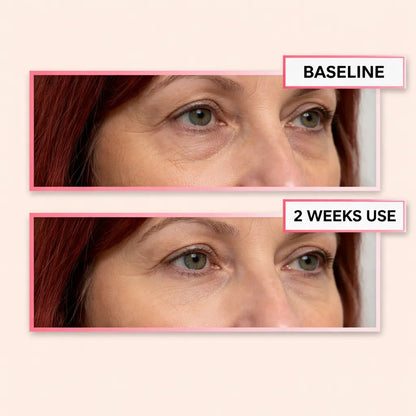 VeRuxy™  LumiEye Therapy Massager Veruxy