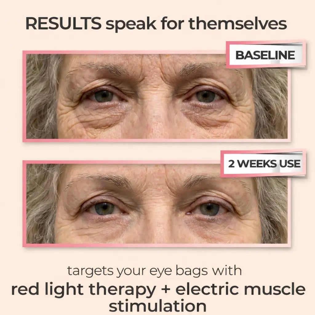 VeRuxy™  LumiEye Therapy Massager Veruxy