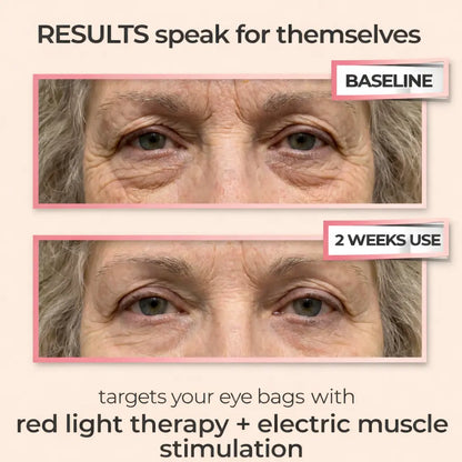 VeRuxy™  LumiEye Therapy Massager Veruxy